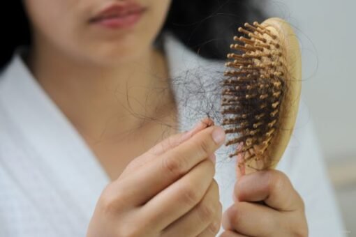 Hair Loss During Menopause